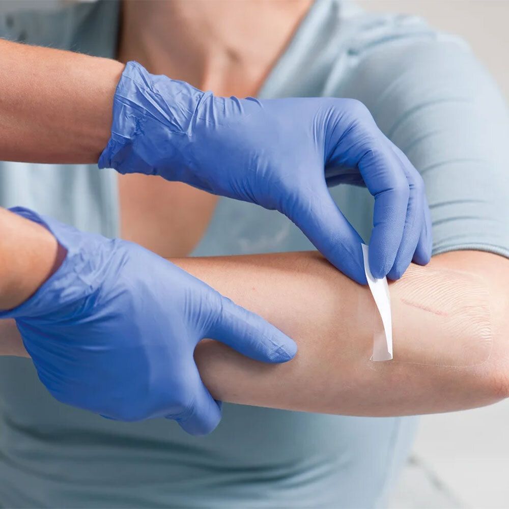 Hände mit blauen Handschuhen legen eine transparente Verbandfolie auf einen Unterarm.