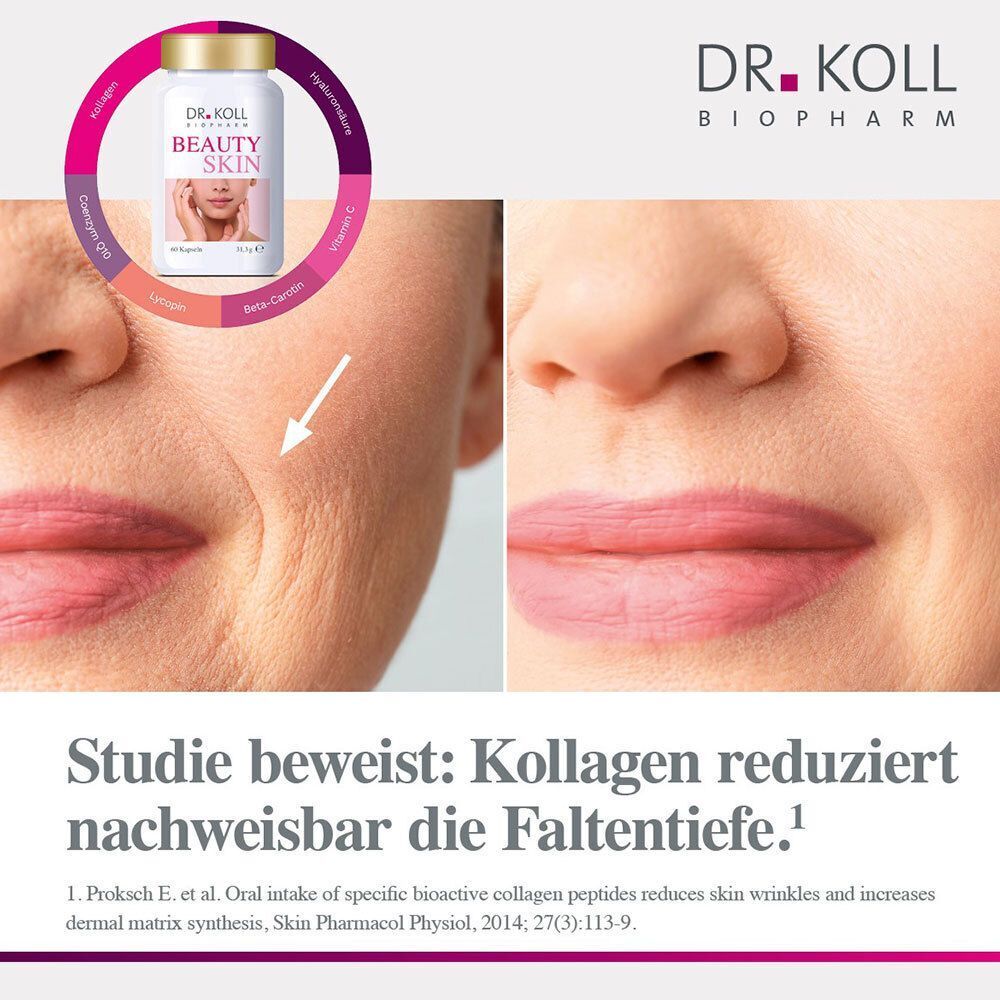 DR. KOLL BEAUTY SKIN: Vorher-Nachher-Vergleich von Faltenreduktion durch Kollagen.