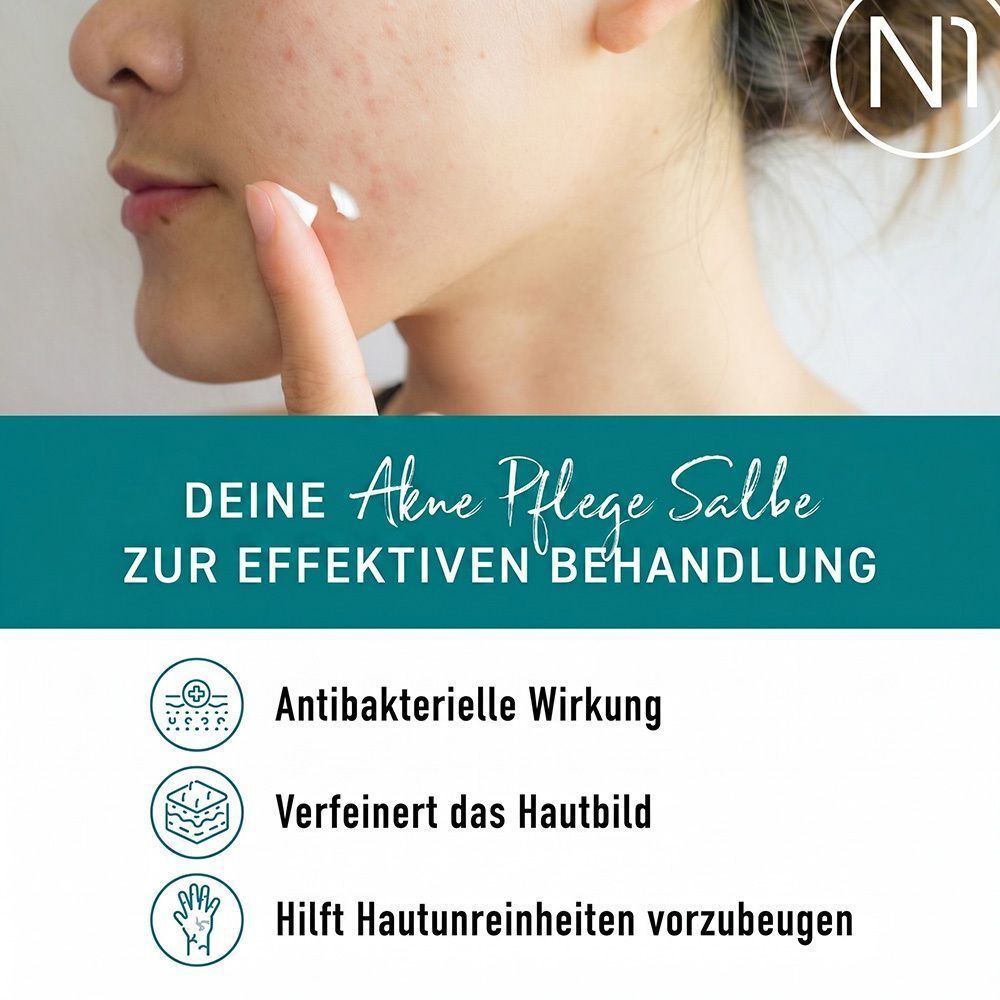 Nahaufnahme einer Person, die N1 Akne-Pflege Salbe auf unreine Haut aufträgt.