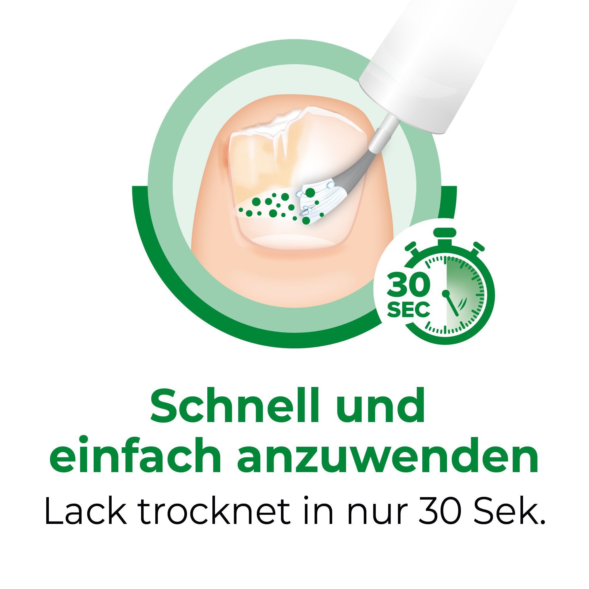 Anwendung von CICLOPIROX Nagellack auf einen infizierten Nagel. Lack trocknet in 30 Sekunden.