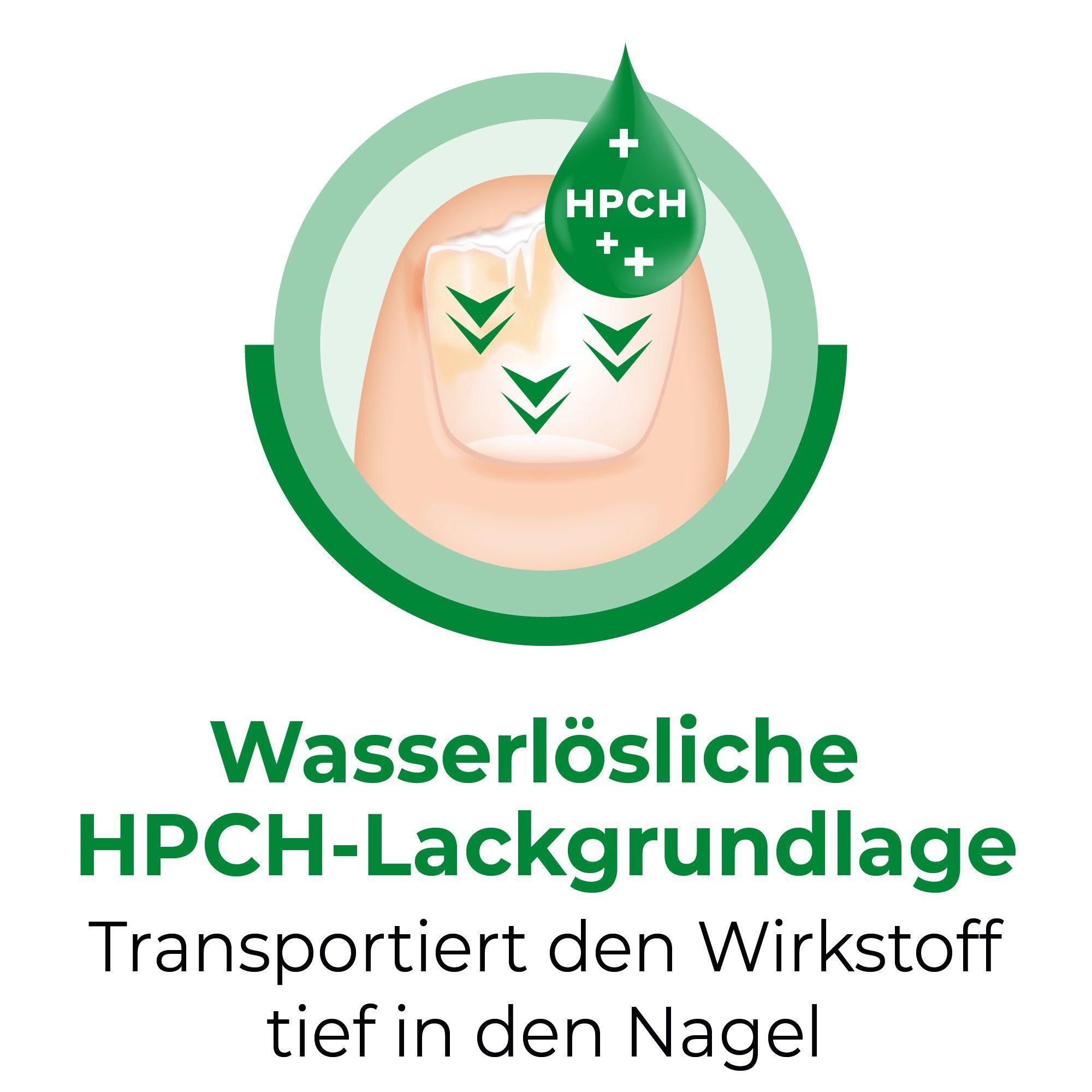 CICLOPIROX Nagellack mit HPCH-Lackgrundlage transportiert Wirkstoff tief in den Nagel.