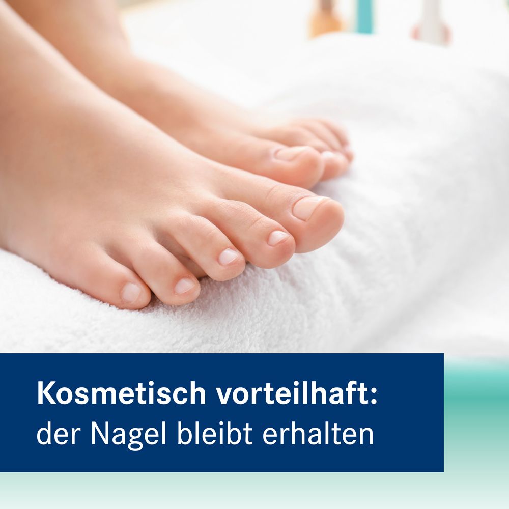 Amorolfin Nagelkur Heumann 5% wirkstoffhaltiger Nagellack