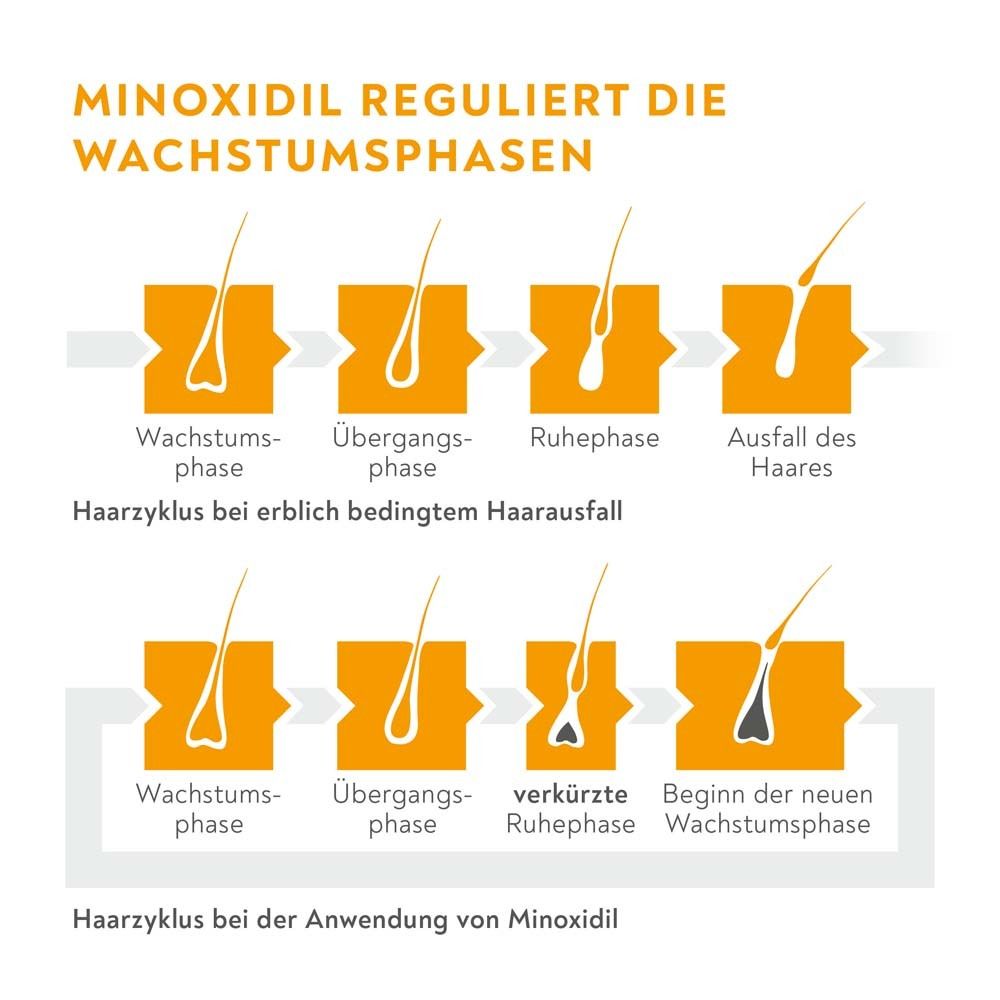 Schema des Haarzyklus bei Haarausfall und bei Anwendung von Minoxidil, das die Wachstumsphasen erklärt.