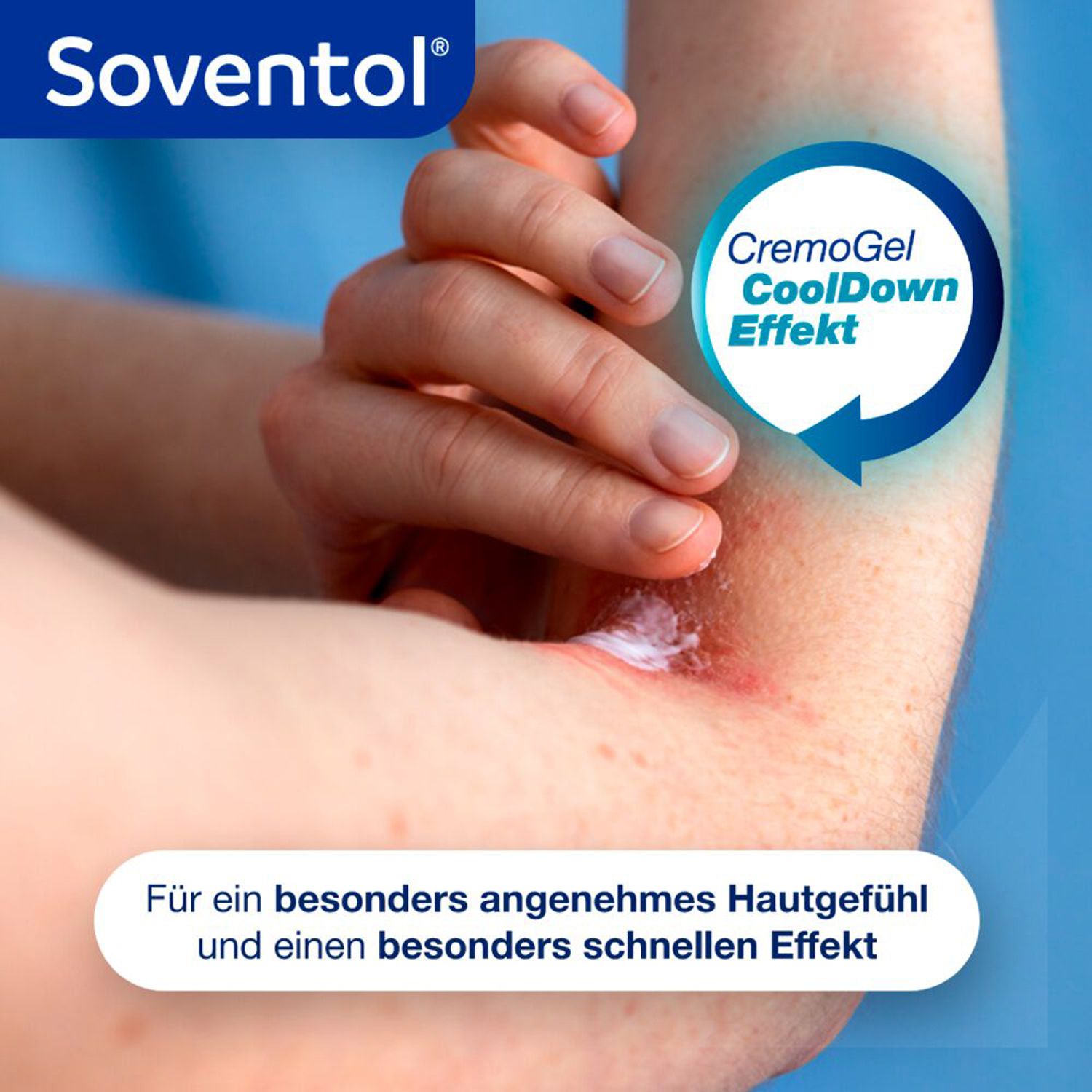 Soventol HydroCortisonACETAT 0,5% Hautentzündungen - Jetzt 2€ mit dem Code soventol2 sparen*
