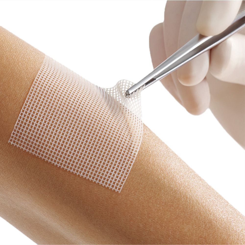 Lomatuell® Pro 5 cm x 5cm steril 8 St Wundgaze