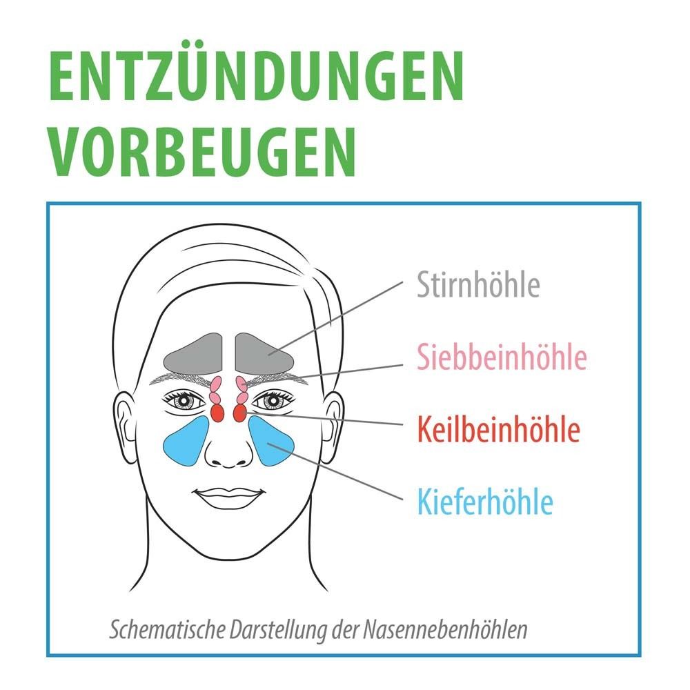 Schematische Darstellung der Nasennebenhöhlen. Beschriftung der Stirnhöhle, Siebbeinzellen, Keilbeinhöhle, Kieferhöhle.