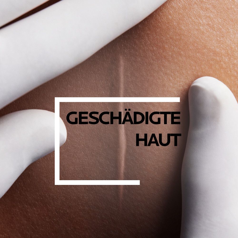Geschädigte Haut. Nahaufnahme einer Hautpartie mit einer Narbe.