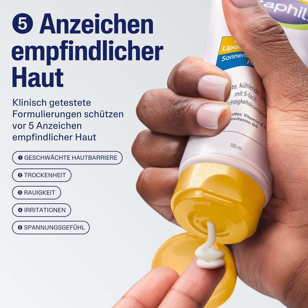 Hand drückt Lotion aus Tube. Text: 5 Anzeichen empfindlicher Haut. Geschwächte Hautbarriere, Trockenheit, etc.