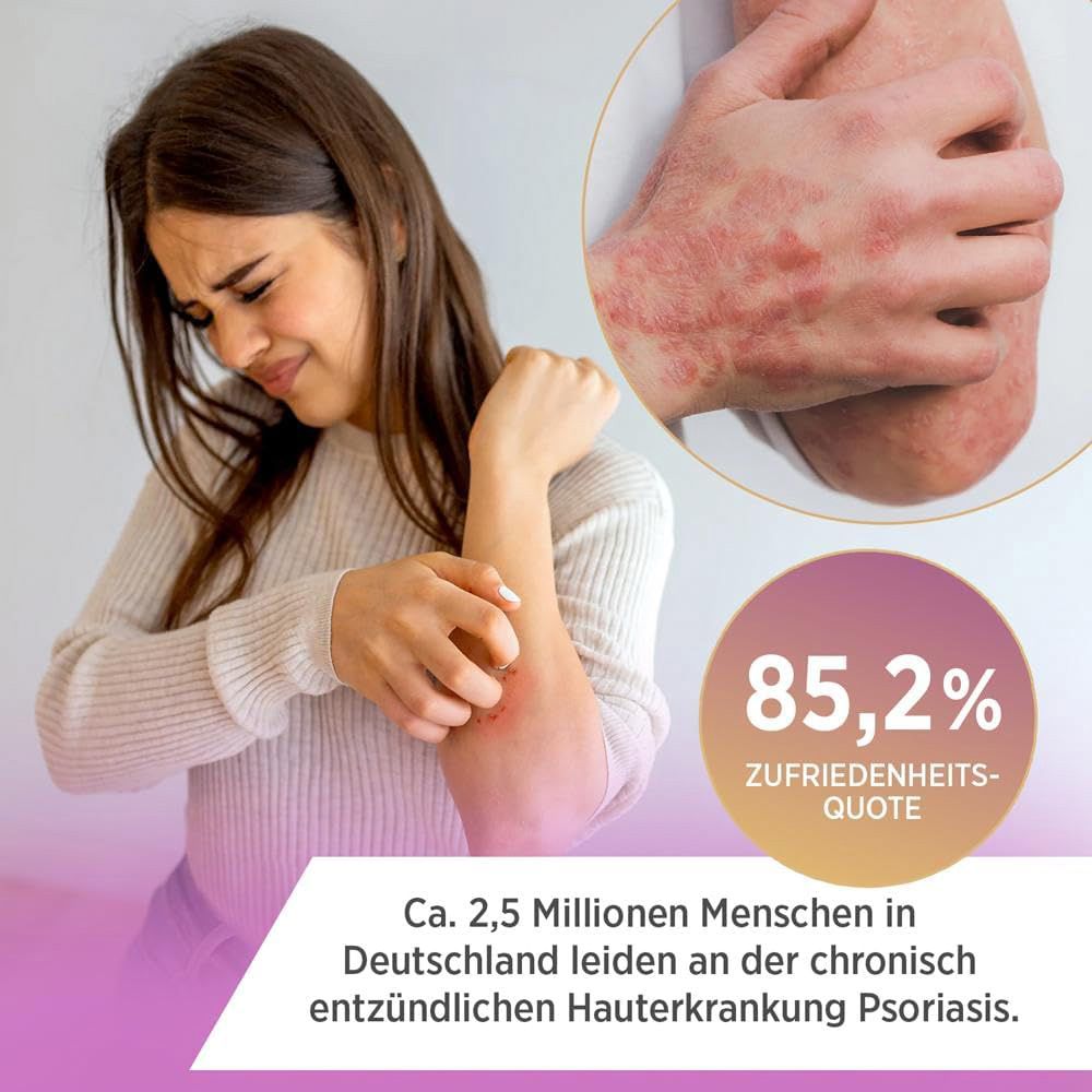Frau kratzt sich am Arm wegen Psoriasis, 85,2% Zufriedenheitsquote.