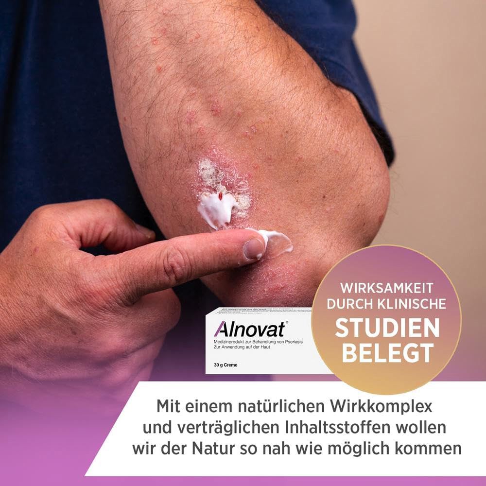 Alnovat Creme wird auf eine von Psoriasis betroffene Ellenbogenpartie aufgetragen.