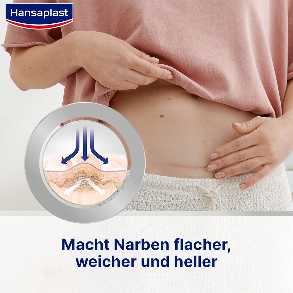 Hansaplast Narben Reduktion XL - Jetzt 20% sparen mit dem Code "pflaster20"
