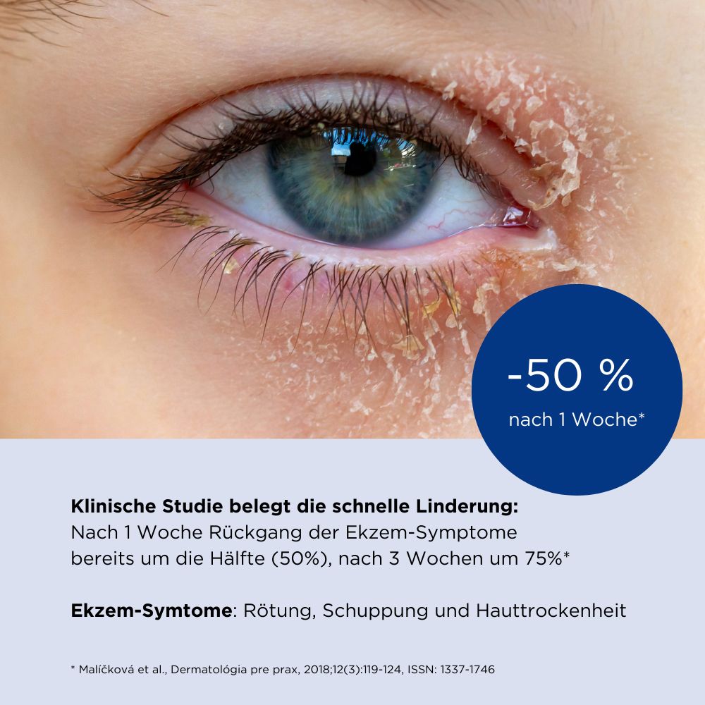 ALLERGIKA® Augenlidcreme MED - Jetzt 2€ sparen mit Code "allmed2"