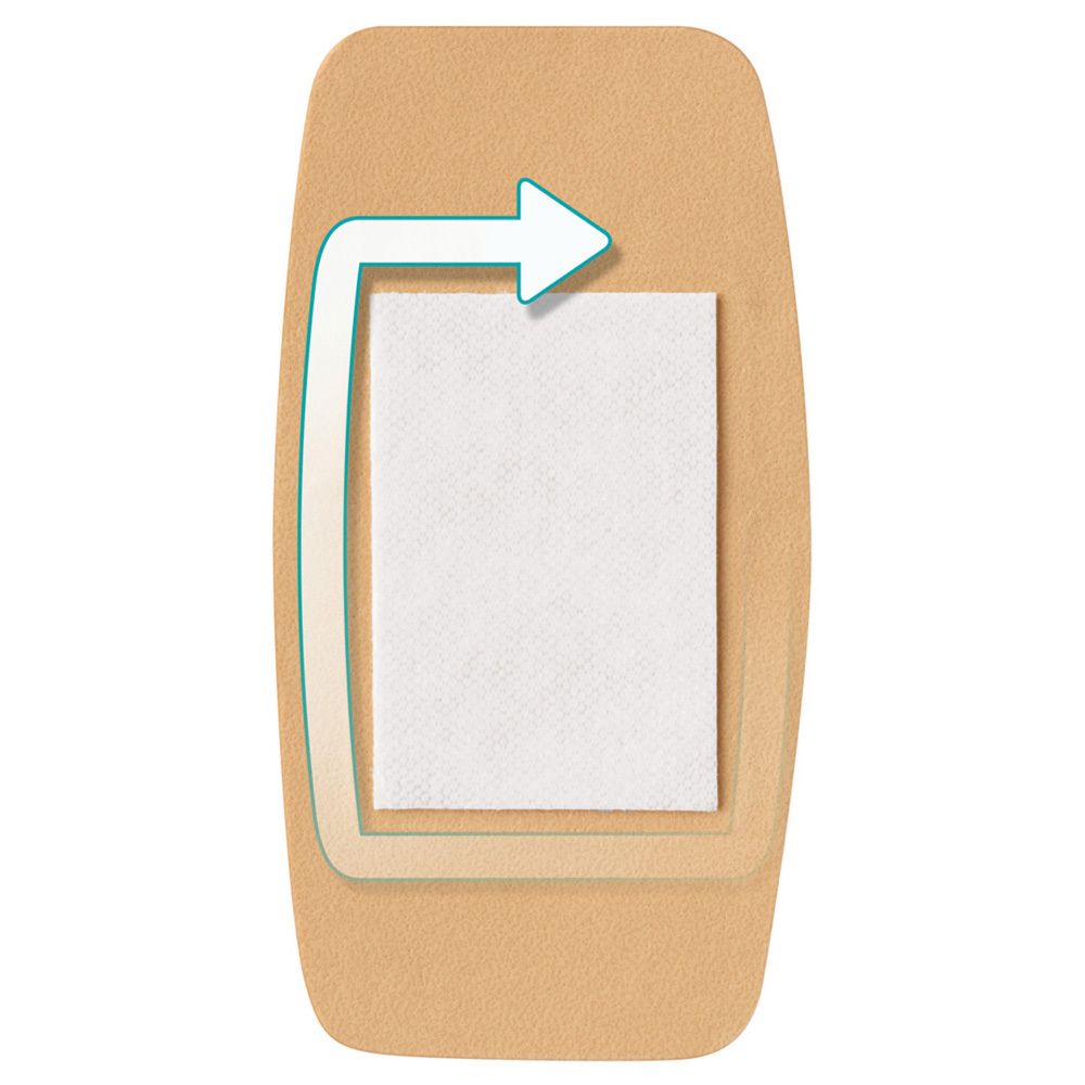 Beige, rechteckiges Pflaster mit einem weißen, quadratischen Bereich in der Mitte. Pfeil zeigt Richtung.