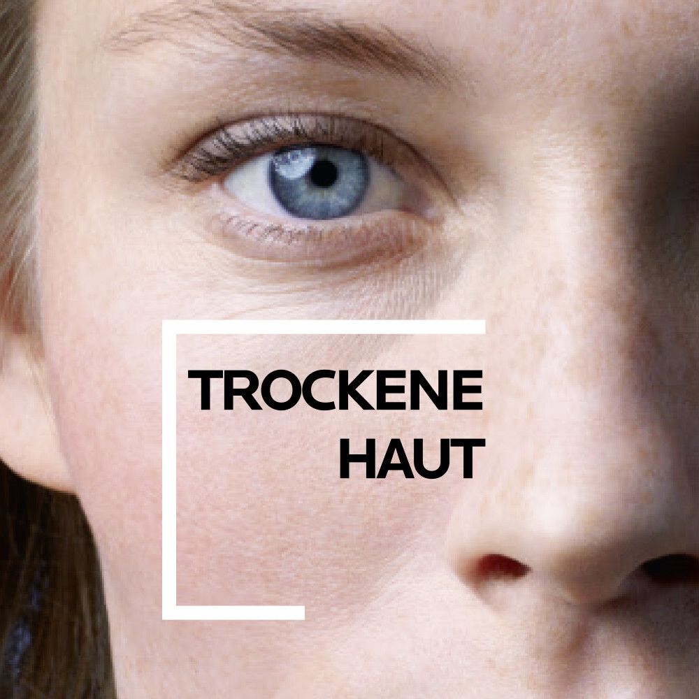 Gros plan sur un visage. Texte : PEAU SÈCHE. Aspect de la peau.