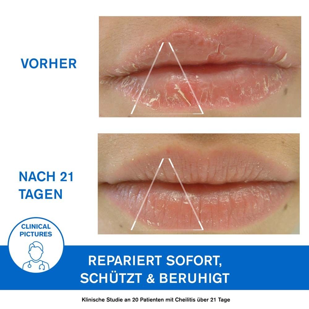 URIAGE BARIÉDERM-CICA Lippenpflege