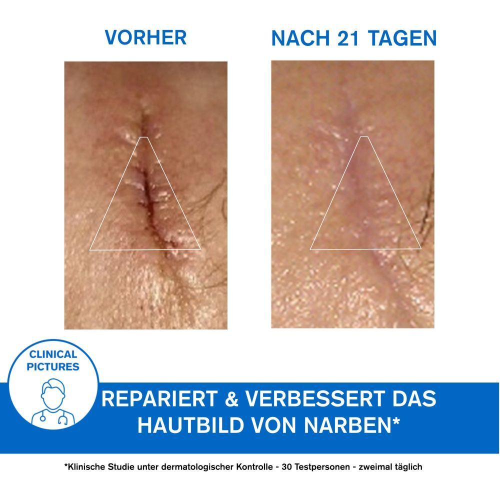 URIAGE BARIÉDERM-CICA Creme