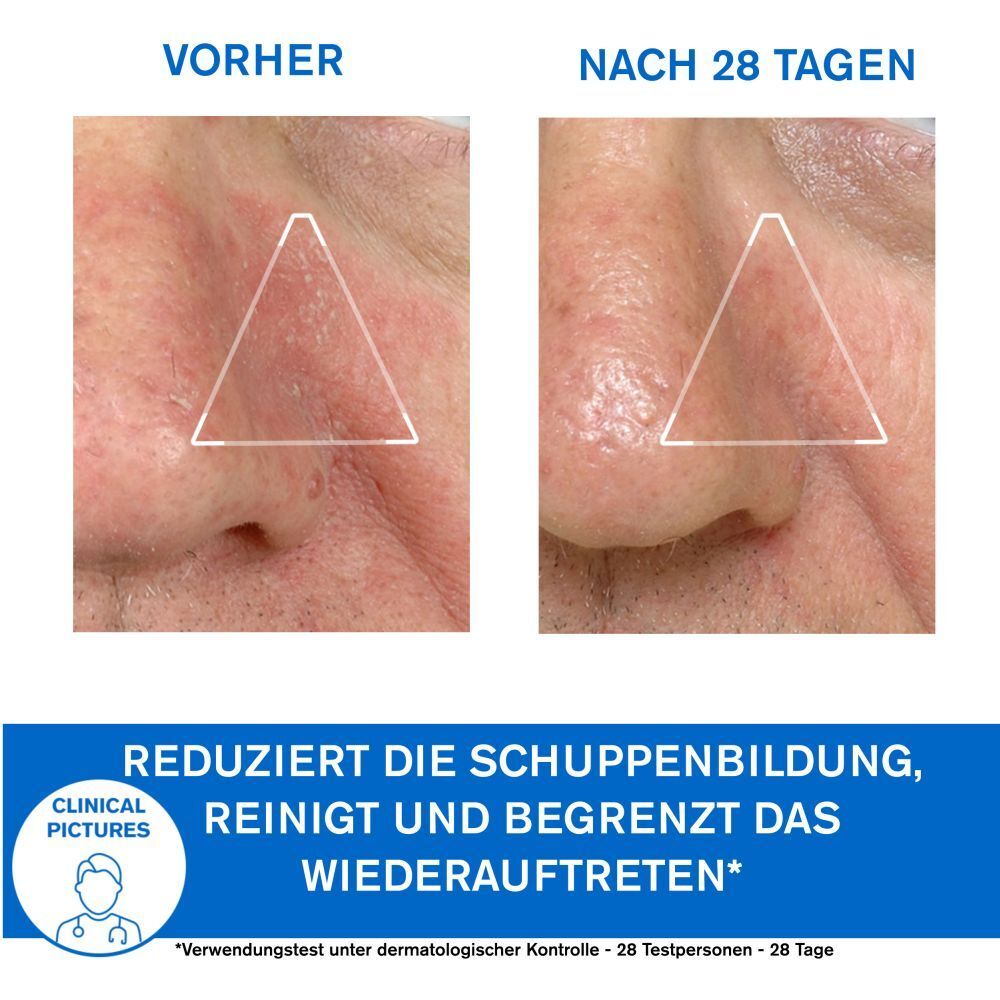 URIAGE DS regulierende beruhigende Emulsion