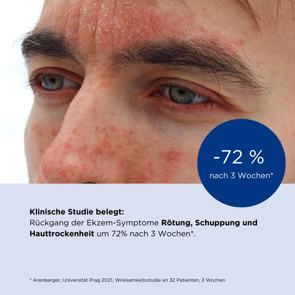 ALLERGIKA® Gesichtscreme MED - Jetzt 2€ sparen mit Code "allmed2"