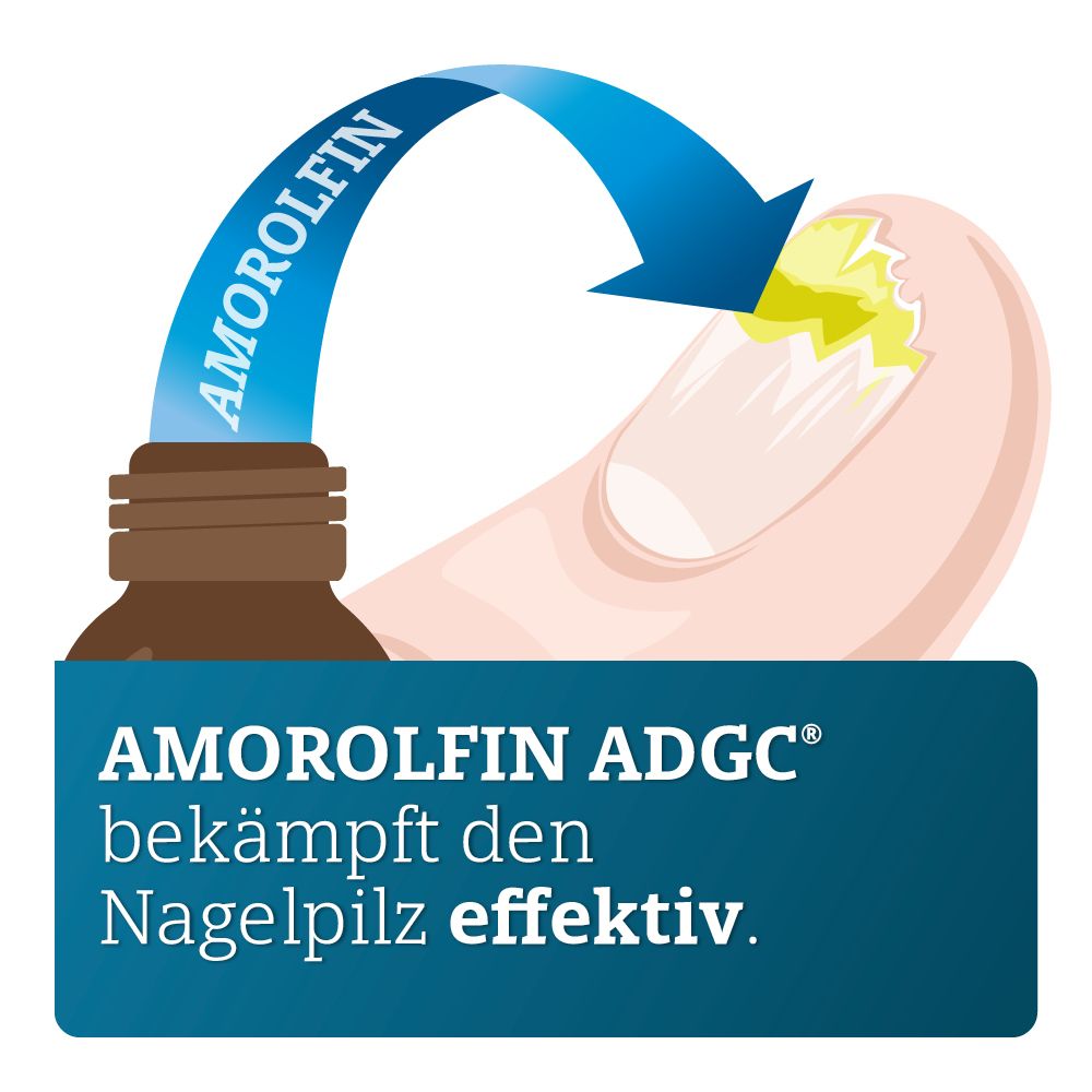 AMOROLFIN ADGC® wirkstoffhaltiger Nagellack gegen Nagelpilz inkl. Set