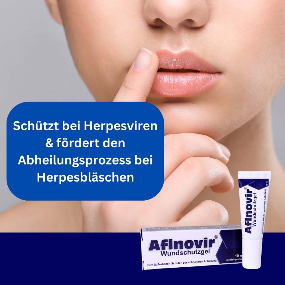 Gesicht mit Text: Schützt bei Herpesviren & fördert den Abheilungsprozess bei Herpesbläschen. Afinovir.