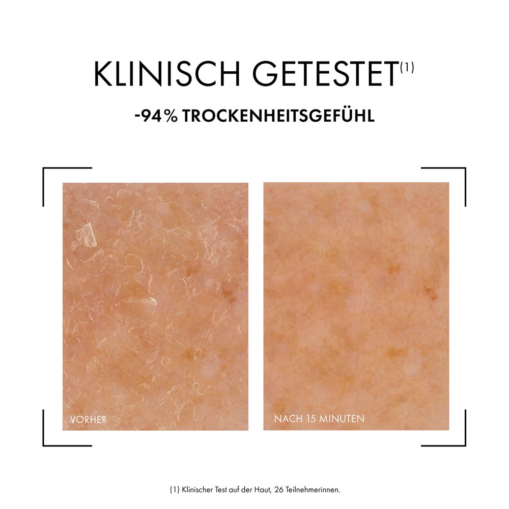 Hautbilder Vorher/Nachher. Text: Klinisch getestet. -94% Trockenheitsgefühl. (1) Klinischer Test an der Haut von 26 Teilnehmern.