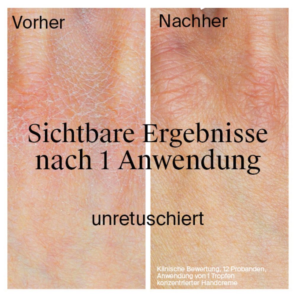 Hände, vorher/nachher. Text: Sichtbare Ergebnisse nach 1 Anwendung. Klinische Bewertung.