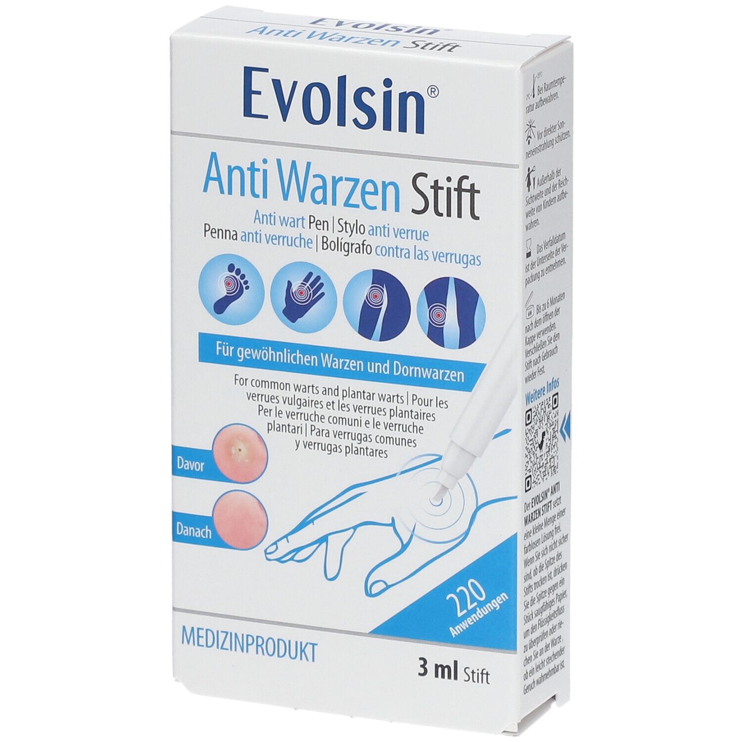Evolsin – Penna-antiverruca contro le verruche su piedi, mani, corpo, braccia & gambe