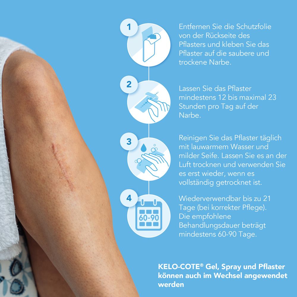 Anleitung zur Anwendung des Kelo-Cote Narbenpflasters. Schritte 1-4. Bis zu 21 Tage wiederverwendbar. 60-90 Tage Behandlung.