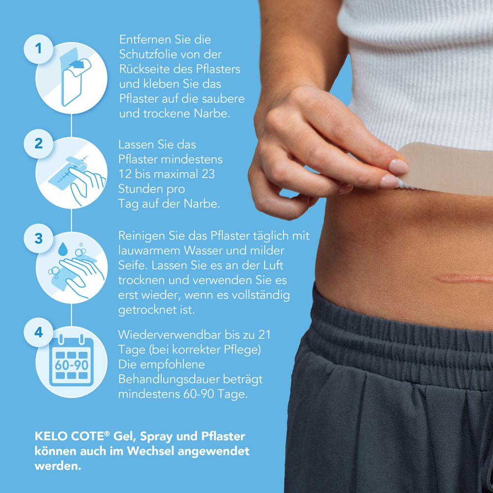 Anleitung zur Anwendung des Pflasters. Schritt 1-4. KELO-COTE® Gel, Spray und Pflaster können im Wechsel angewendet werden.
