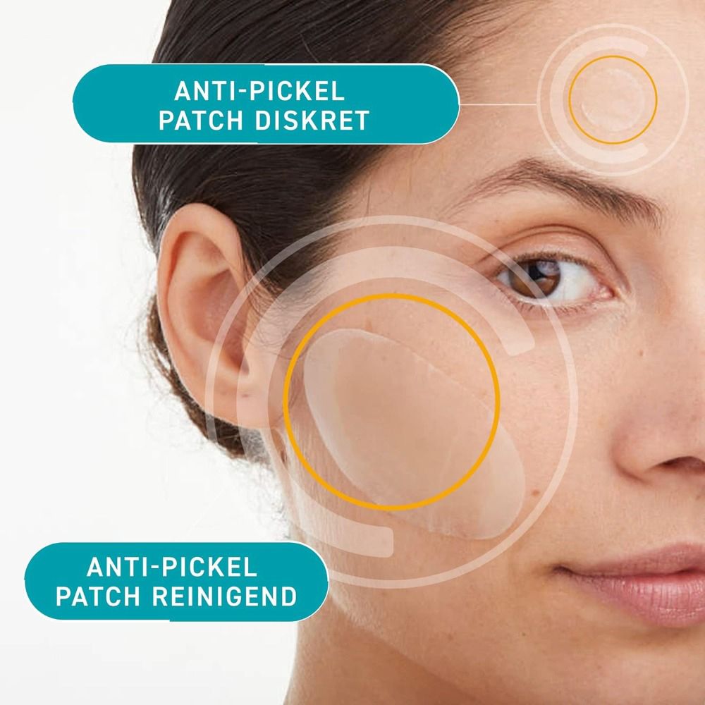 Gesicht mit zwei compeed® Anti-Pickel Patches. Ein Patch diskret, der andere reinigend. Kreise um die Patches.