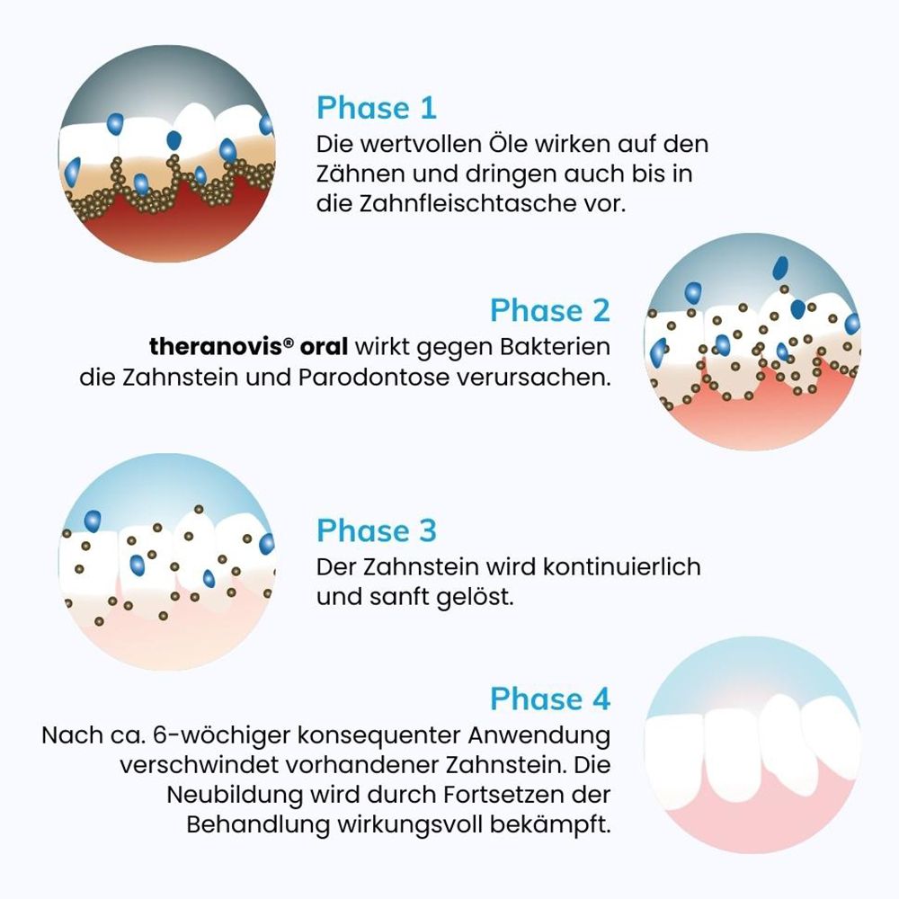 Theranovis oral Zahnstein Spray 65 ml