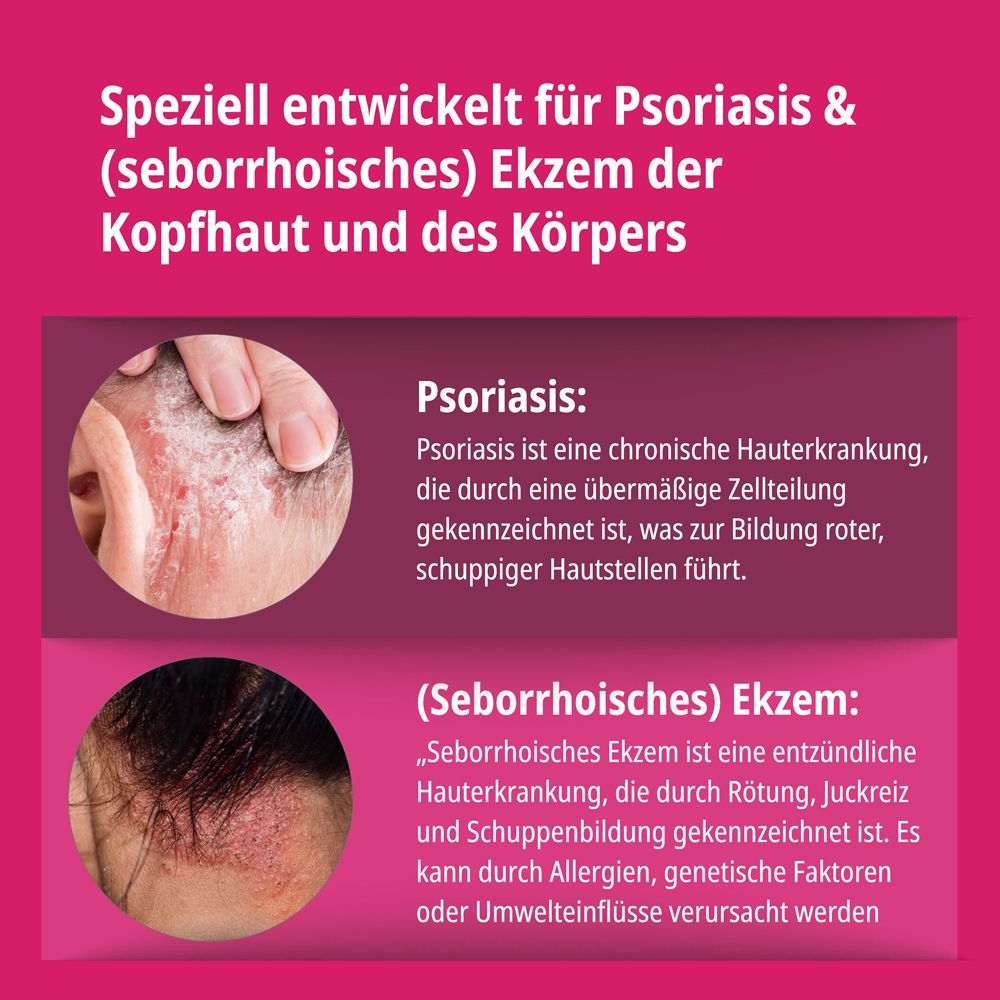 Produkt und Verpackung. Aufschrift: Evolsin Ekzem & Psoriasis Lotion für Kopfhaut & Körper. 100 ml.