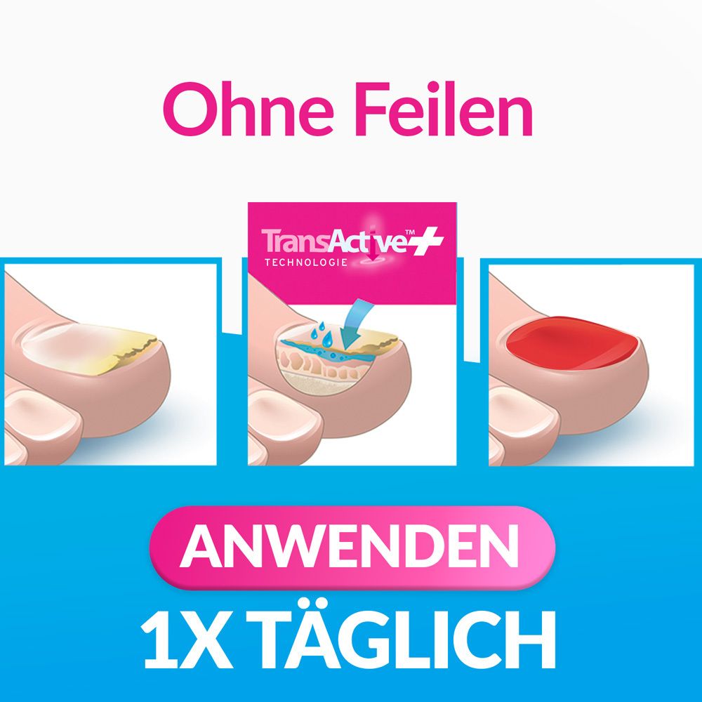 EXCILOR Intensiv Color - Lack gegen Nagelpilz - Hochwirksame Formel gegen Fußpilz