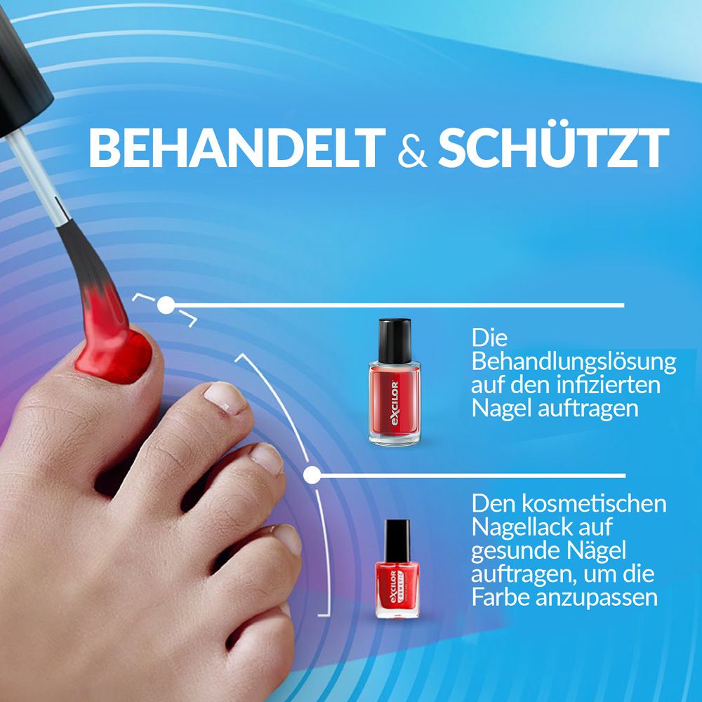 Fuß mit Nagelpilz. Pinsel mit roter Flüssigkeit. Zwei Nagellackflaschen. Text: Behandelt & schützt.