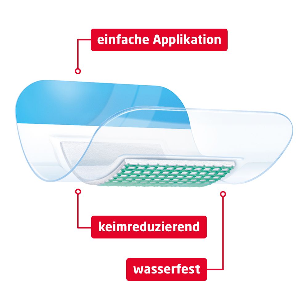Detailansicht eines Leukomed® Sorbact Verbandes: einfache Applikation, keimreduzierend, wasserfest.