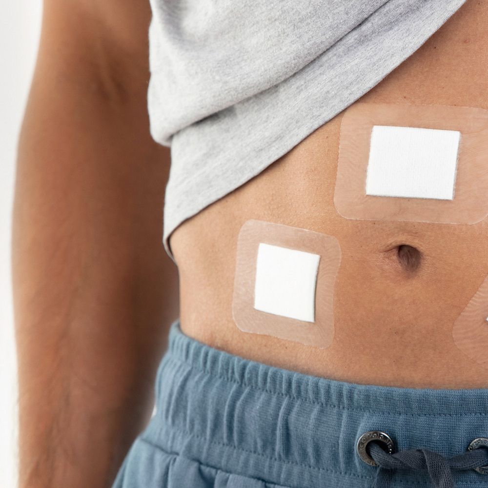 Anwendung von Leukomed® Sorbact Verbänden auf der Bauchregion einer Person.