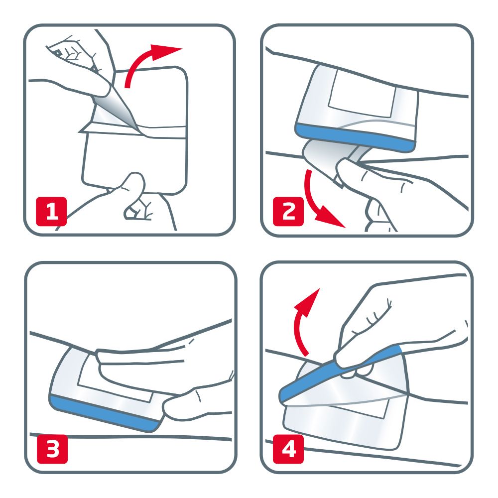 Anleitung zur Anwendung von Leukomed® Sorbact: 4 Schritte zur korrekten Anbringung.