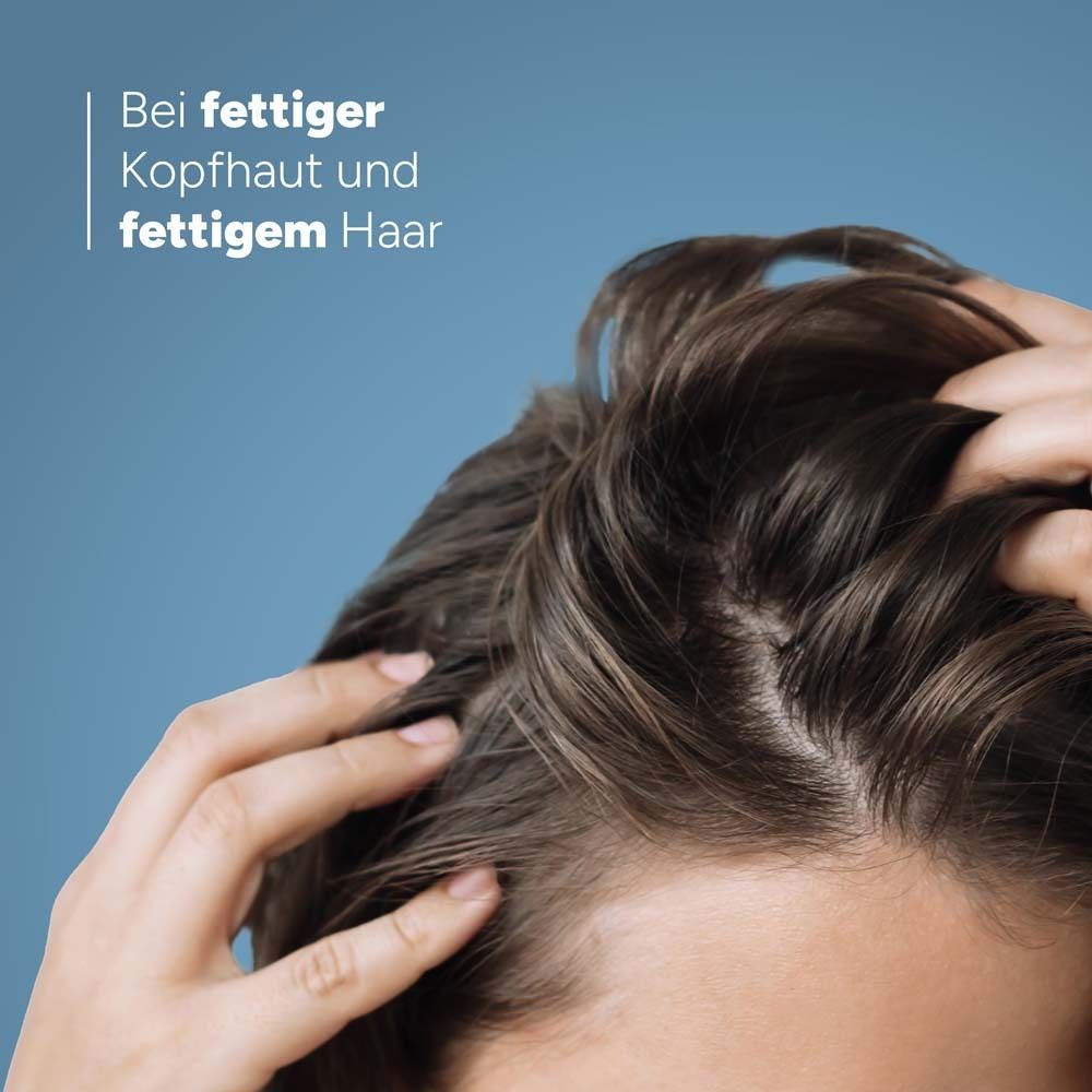 Nahaufnahme von fettigem Haar und Kopfhaut. Hände berühren die Kopfhaut. Text: Bei fettiger Kopfhaut und fettigem Haar.