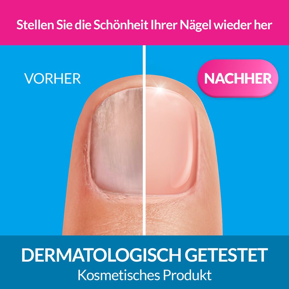 Vergleichsbild: Nagel vor und nach der Anwendung. Text: Dermatologisch getestet. Kosmetisches Produkt.