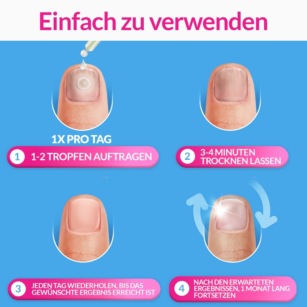 Anwendungsbeispiel: 4 Schritte. 1-2 Tropfen auftragen. 3-4 Minuten trocknen lassen. Täglich wiederholen.