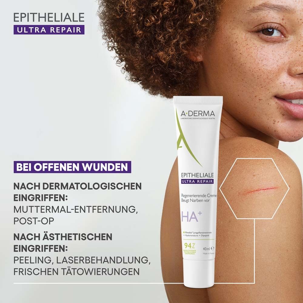 A-DERMA EPITHELIALE ULTRA REPAIR Creme. Tube neben Haut mit Narbe. Text: Bei offenen Wunden, nach Eingriffen. Produktname und HA+.