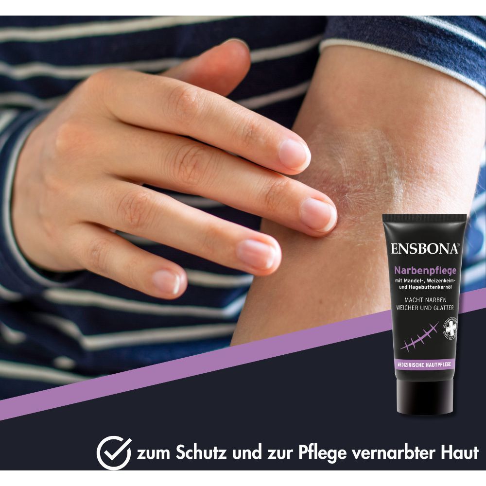 Hand trägt Ensbona Narbenpflege auf eine Narbe am Arm auf. Tube im Vordergrund.