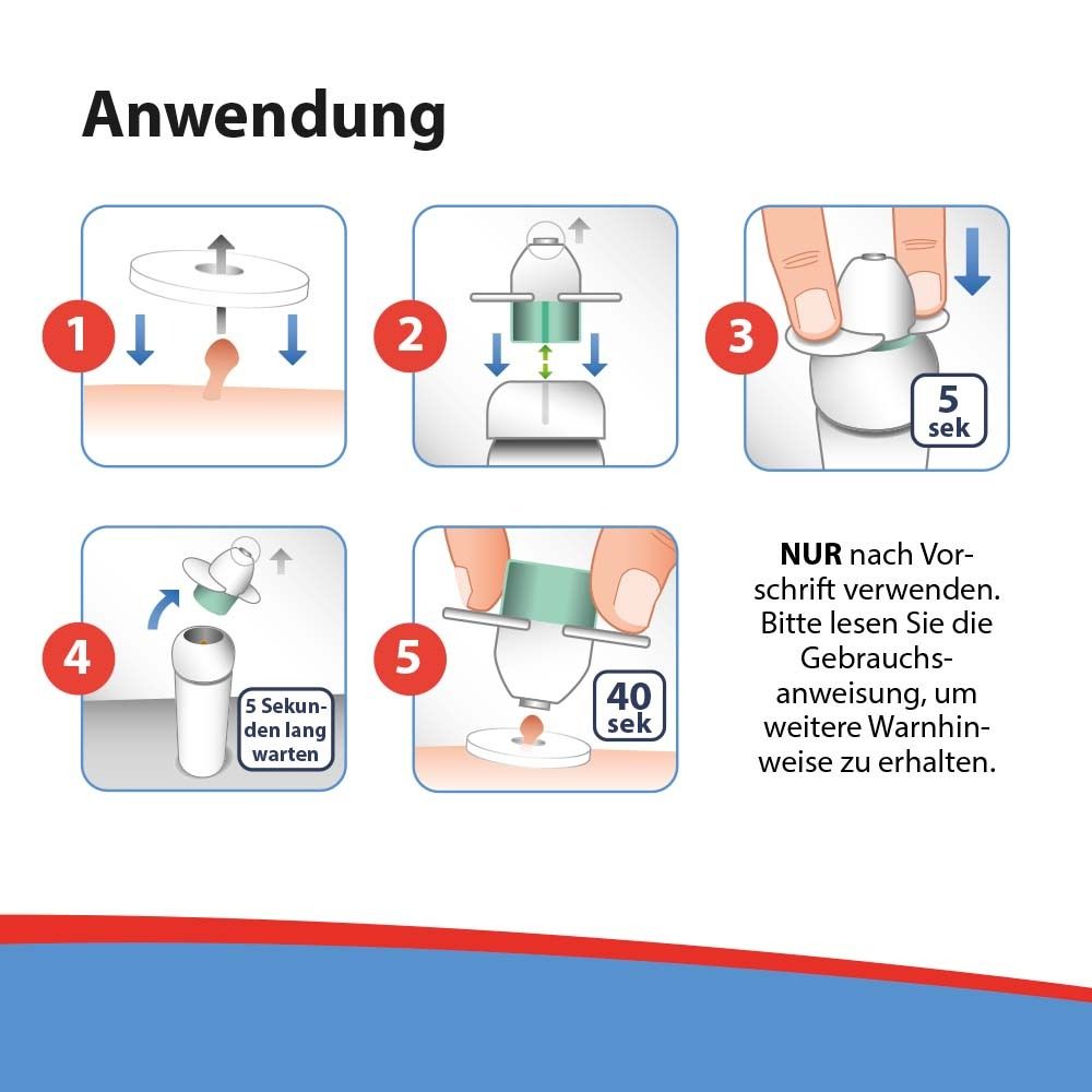 Anwendungsschritte von Acetocaustin Stielwarzen Entferner. Illustrationen zeigen die Anwendung.
