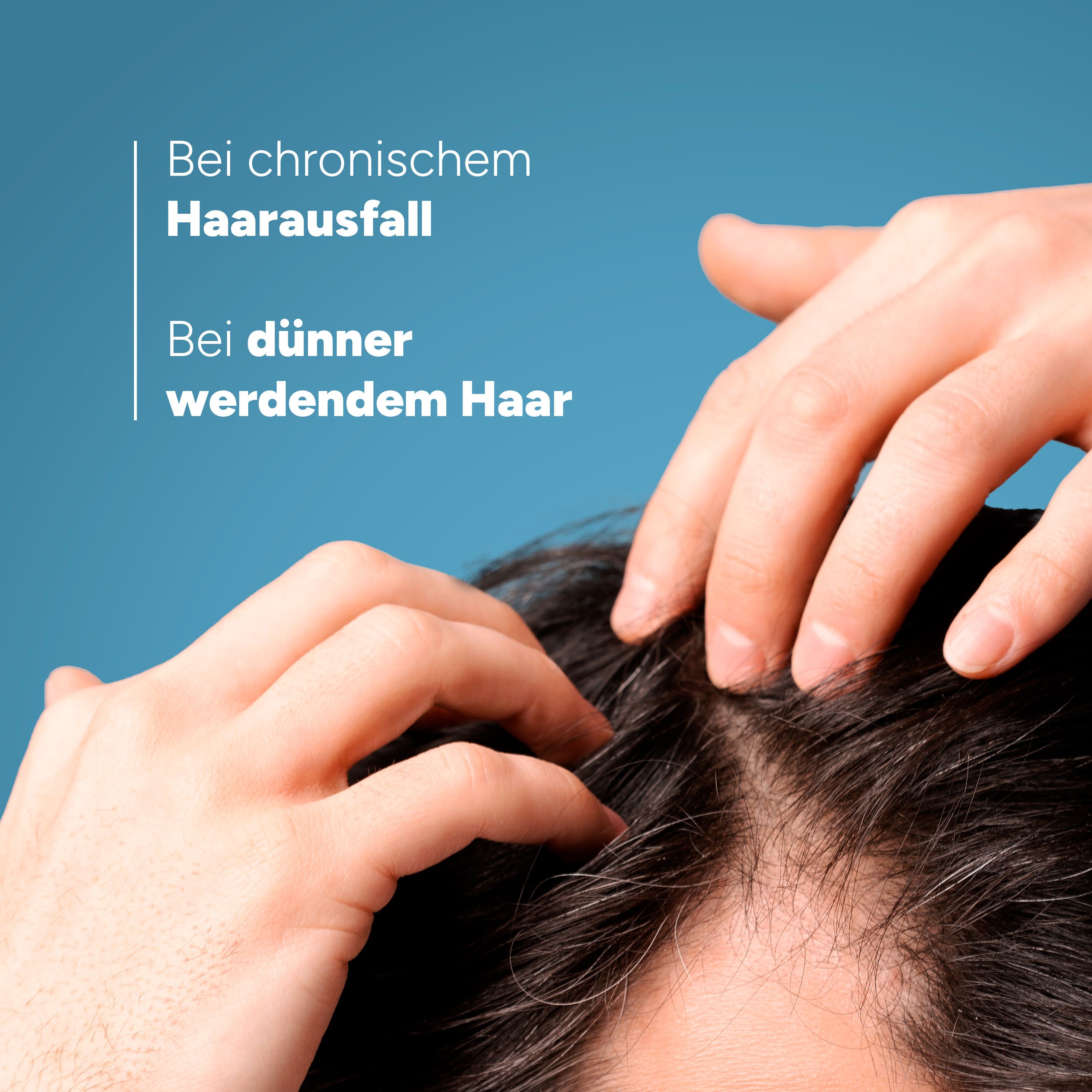 Hände auf Kopfhaut. Text: Bei chronischem Haarausfall. Bei dünner werdendem Haar.