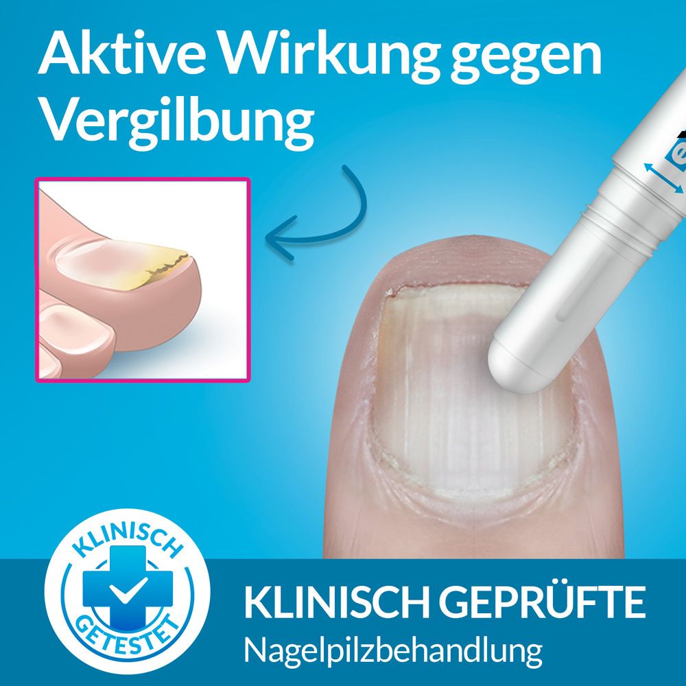 Excilor® Easy Behandlung von Nagelpilz