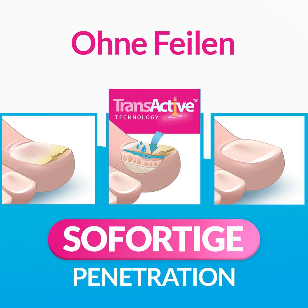 Nagelabbildungen. Text: Ohne Feilen, Sofortige Penetration. Logo: TransActive Technology.
