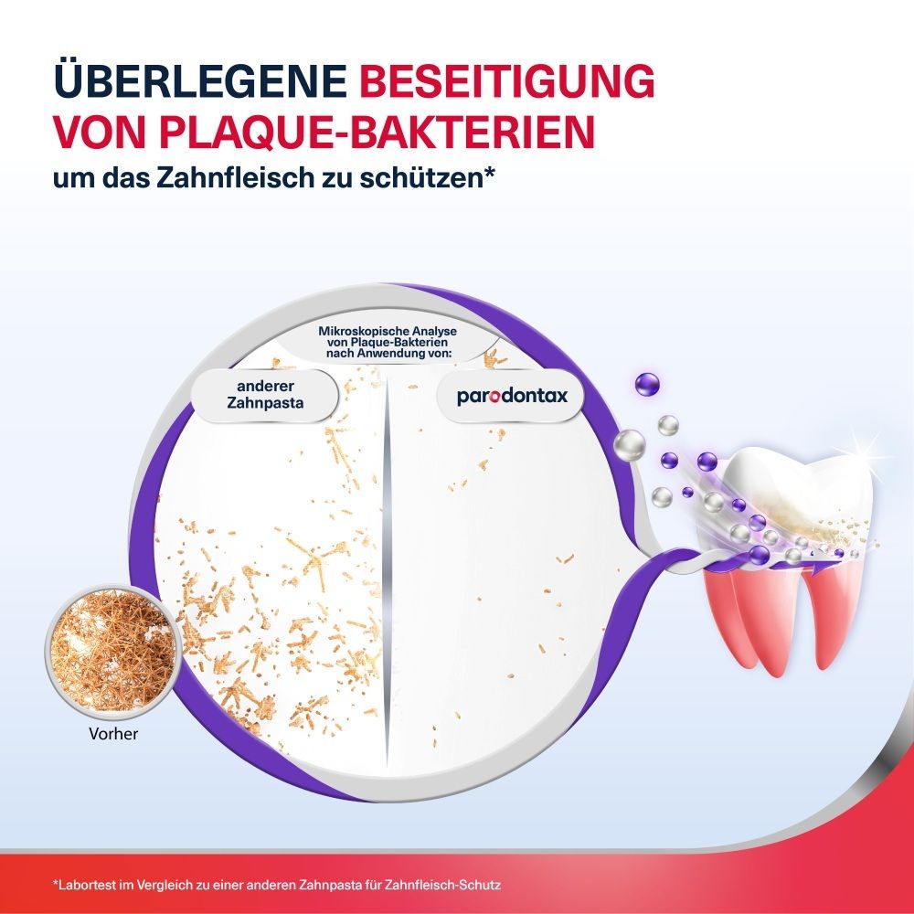 Vergleich der Plaque-Beseitigung durch Parodontax Zahnpasta im Vergleich zu anderer Zahnpasta.
