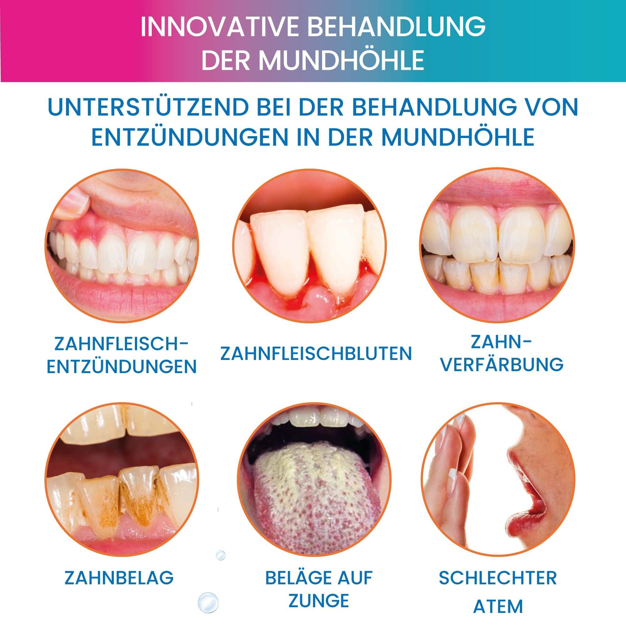 Bilder von Mundproblemen: Zahnfleischentzündung, Zahnfleischbluten, Zahnverfärbung, Zahnbelag, Zungenbeläge, schlechter Atem.