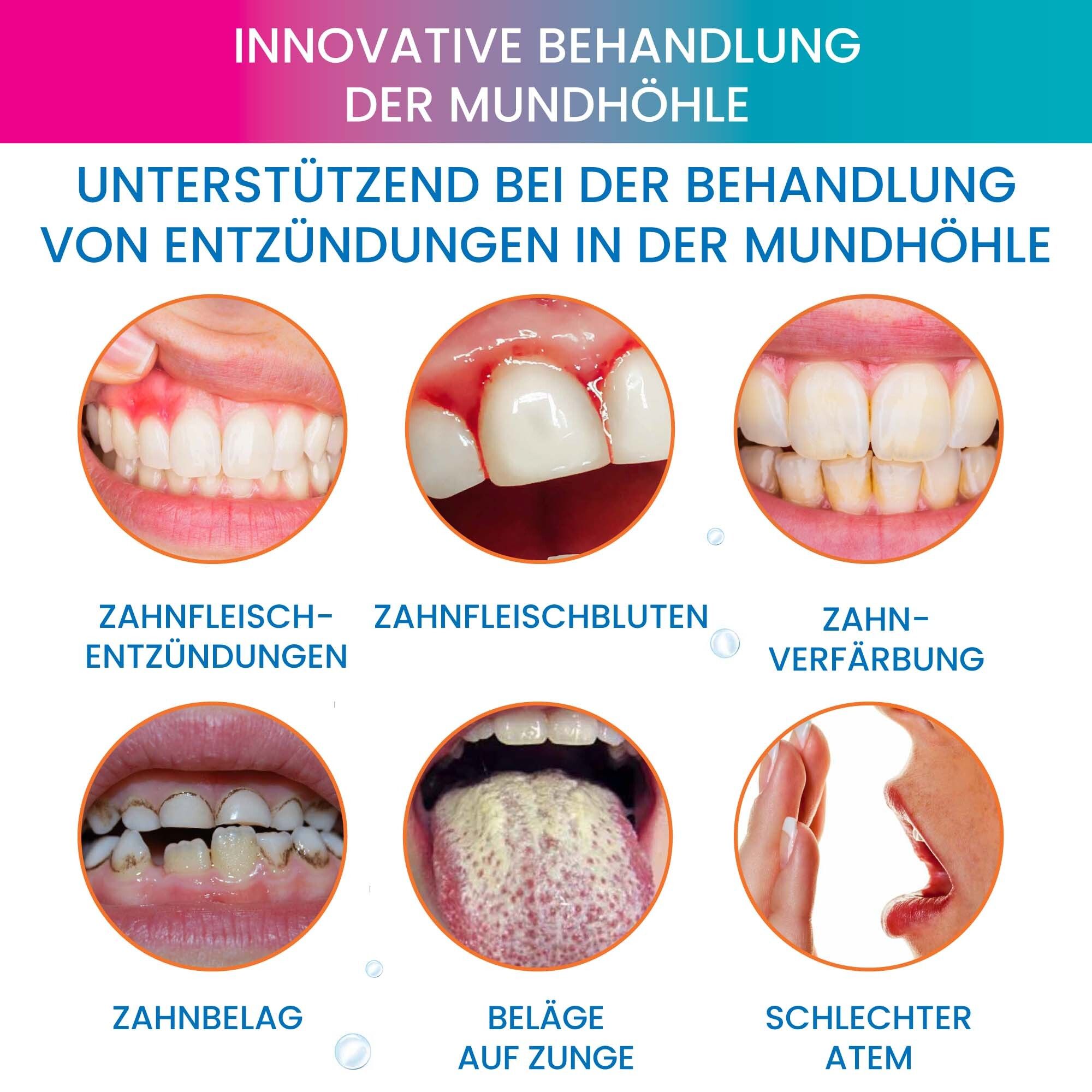Grafik mit Zahnproblemen. Text: Innovative Behandlung der Mundhöhle. Zahnfleischentzündung, -bluten, -verfärbung, Beläge, Mundgeruch.