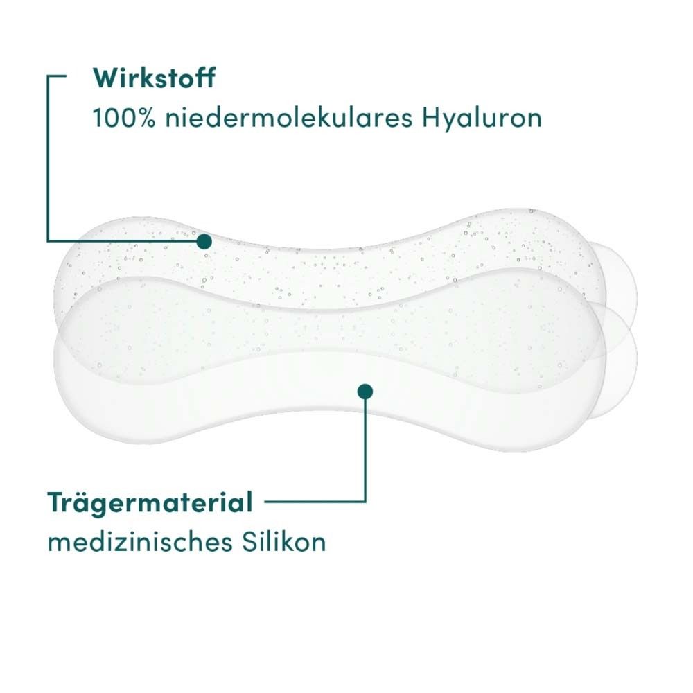 Zwei Mund Pads mit Beschriftung. Wirkstoff: 100% niedermolekulares Hyaluron. Trägermaterial: medizinisches Silikon.